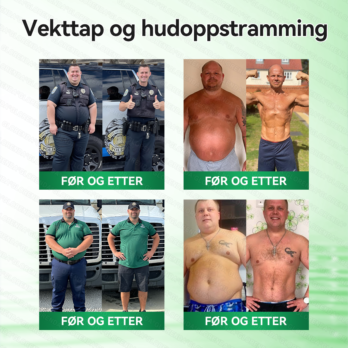 🇳🇴𝑶𝒇𝒇𝒊𝒔𝒊𝒆𝒍𝒍 𝑩𝒖𝒕𝒊𝒌𝒌 | 🩹👨‍⚕️ 𝑮𝑳𝑶𝗥𝗘𝙉𝘿𝐀®𝐌𝒐𝒓𝒊𝒏𝗴𝗮 · 𝗕𝗲𝙧𝙗𝙚𝙧𝙞𝙣 × 𝐍𝐀𝑫+ 10-𝗶-𝟭 𝗔𝙫𝙖𝙣𝙨𝙚𝙧𝙩 𝙉𝐚𝐧𝐨 𝐌𝐢𝒌𝒓𝒐𝒏å𝗹𝗽𝗹𝗮𝘀𝘁𝗲𝗿 (𝑩𝒂𝒓𝒆 é𝒏 𝒈𝒂𝒏𝒈 𝒐𝒎 𝒅𝒂𝒈𝒆𝒏, 𝒔𝒚𝒏𝒍𝒊𝒈𝒆 𝒆𝒏𝒅𝒓𝒊𝒏𝒈𝒆𝒓 𝒑å 7 𝒅𝒂𝒈𝒆𝒓) ✅ 𝑭𝒐𝒓 𝒇𝒆𝒅𝒎𝒆, 🅛🅞🅞🅢🅔 🅢🅚🅘🅝, 𝒅𝒊𝒂𝒃𝒆𝒕𝒆𝒔, 𝒔ø𝒗𝒏𝒂𝒑𝒏é, 𝒍𝒆𝒅𝒅𝒑𝒓𝒐𝒃𝒍𝒆𝒎𝒆𝒓, 𝒐𝒈 𝒎𝒆𝒓